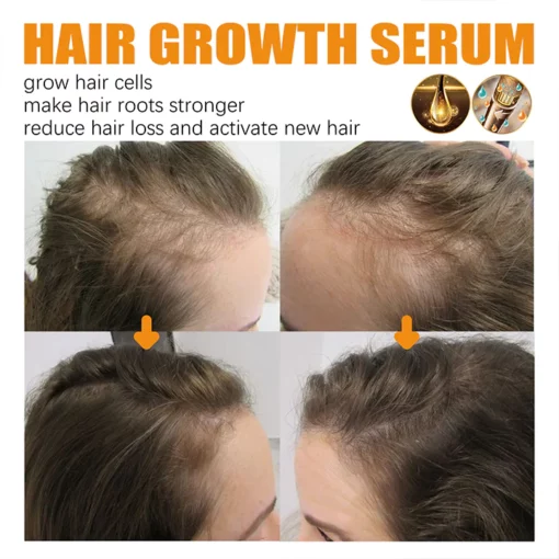 LIMETOW™ Biotin Hair Growth Agent