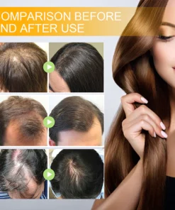 LIMETOW™ Biotin Hair Growth Agent