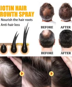 LIMETOW™ Biotin Hair Growth Agent