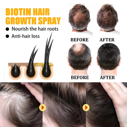 LIMETOW™ Biotin Hair Growth Agent