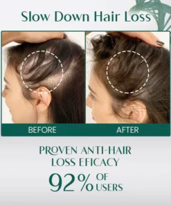 LIMETOW™ Hair Growth Spray