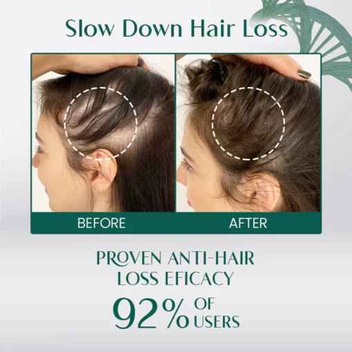 LIMETOW™ Hair Growth Spray