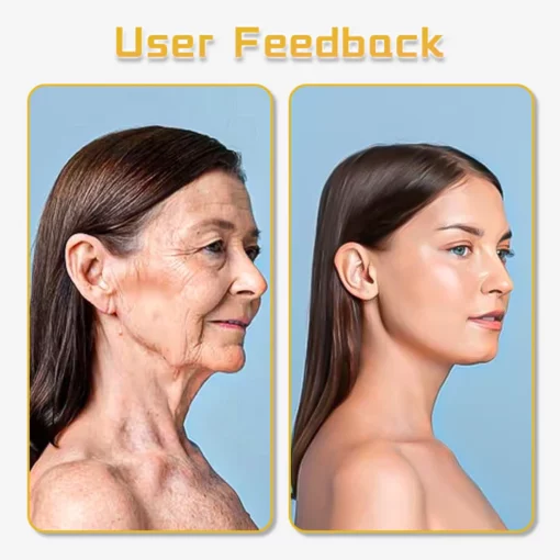 Oveallgo™ UltraRenew Skin Ultrasonic Facelift Device