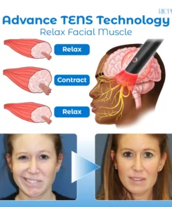 RICPIND Tinnitus NerveTreat InfraredThermal Pen