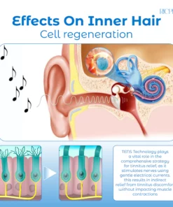 RICPIND Tinnitus NerveTreat InfraredThermal Pen