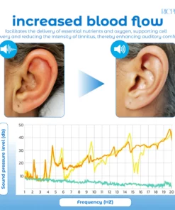 RICPIND Tinnitus NerveTreat InfraredThermal Pen