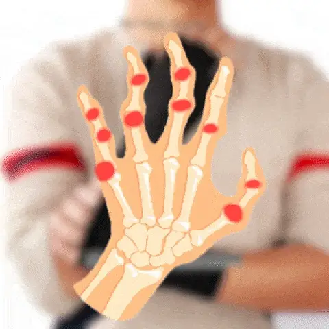 Sugoola™ TourmalineArthritis Compression Gloves 