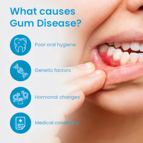 UNPREE™ Gum Shield Therapy Gel