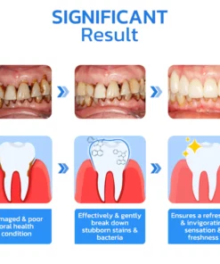 UNPREE™ Gum Repair Strips