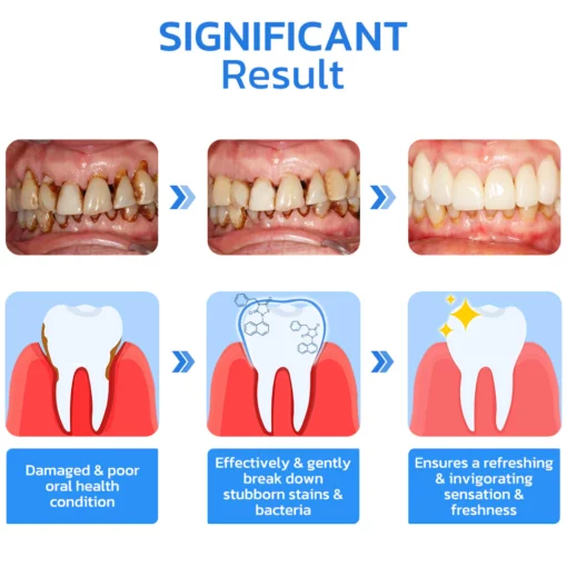 UNPREE™ Gum Repair Strips