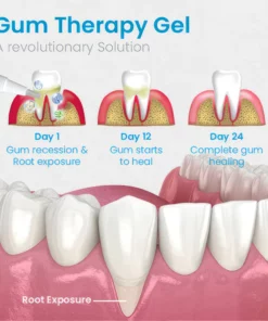 UNPREE™ Gum Shield Therapy Gel