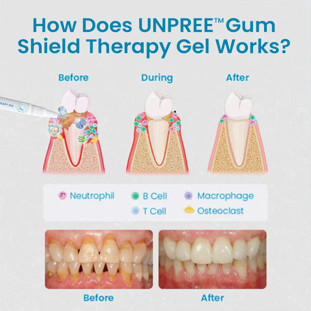 UNPREE™ Gum Shield Therapy Gel