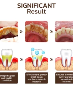 UNPREE™ Niacinamide Whitening Toothpaste