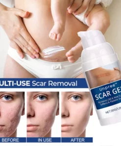 UNPREE™ Silicone Scar Removal Gel