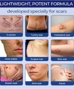 UNPREE™ Silicone Scar Removal Gel