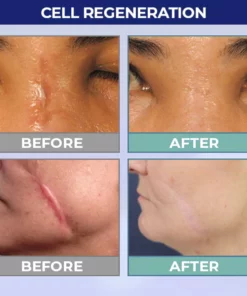 UNPREE™ Silicone Scar Removal Gel