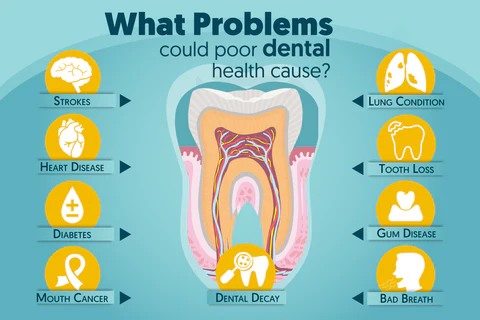 UNPREE™ Teeth Repairing Foam