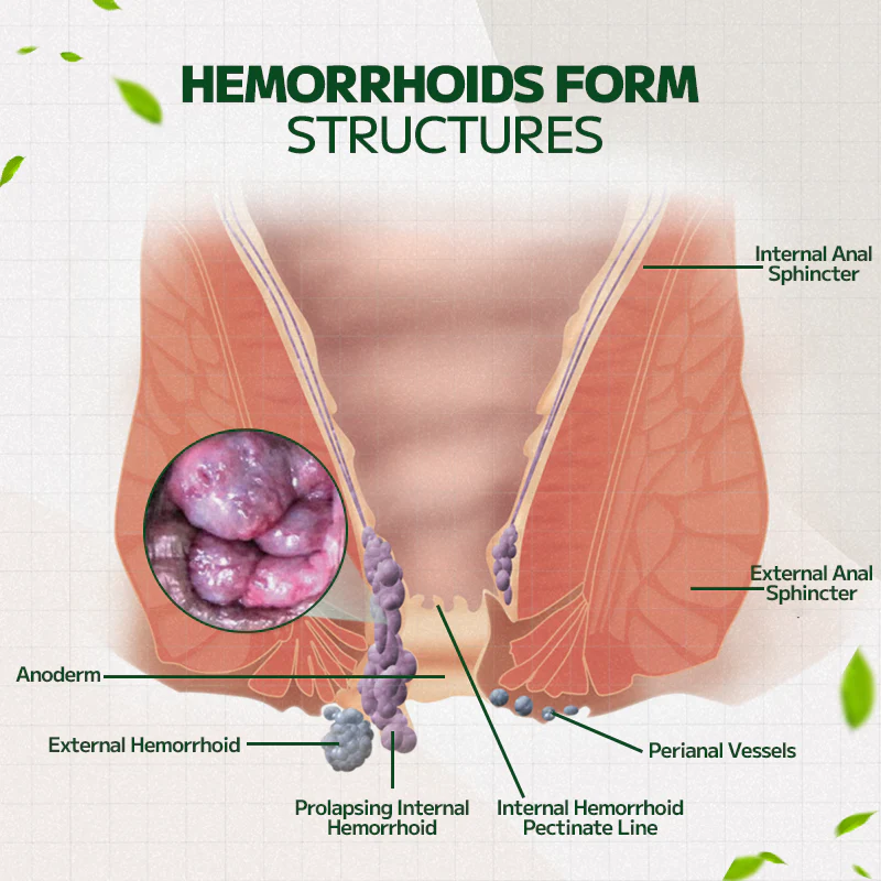 Fivfivgo™ Hämorrhoidal-Salbe