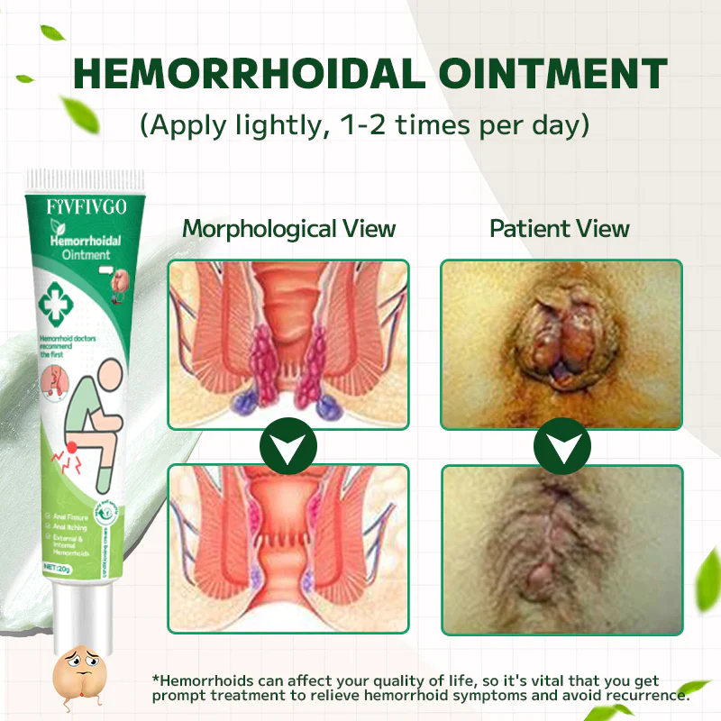 Fivfivgo™ Hämorrhoidal-Salbe