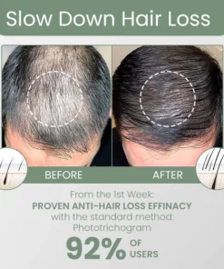 Fivfivgo™ FolliclePLUS Hair Growth Drops