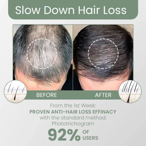 Fivfivgo™ FolliclePLUS Hair Growth Drops