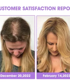 Oveallgo™ Hair Follicle Repair Hair Growth Drops - Achieve thicker hair quickly