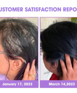 Oveallgo™ Hair Follicle Repair Hair Growth Drops - Achieve thicker hair quickly