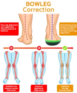 GFOUK™ BowlegOut Tourmaline Alignment Calcium Insoles