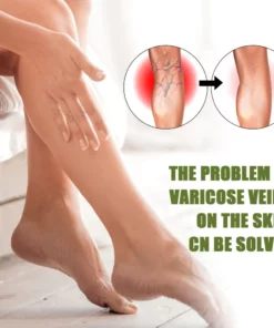 Lovild™ Varicose Veins Spray