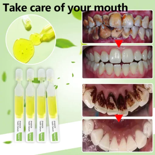 Seurico™Whitening toothpaste essence Removal of tartar and plaque bacteria and various oral problems