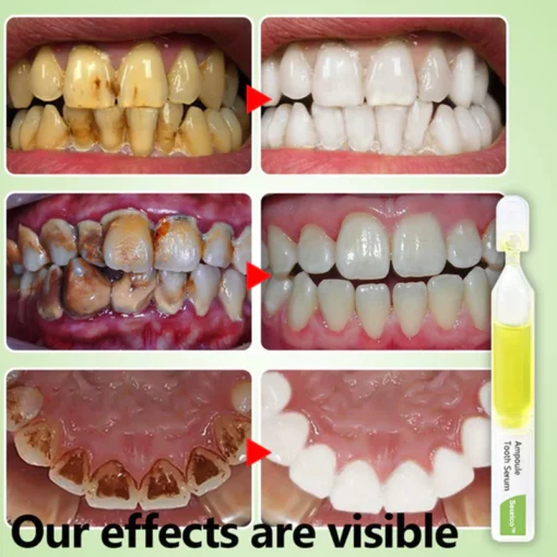 Seurico™Whitening toothpaste essence Removal of tartar and plaque bacteria and various oral problems