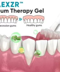 AEXZR™ Gum Therapy Gel