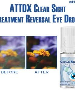 ATTDX Clear Sight Treatment Reversal Eye Drops