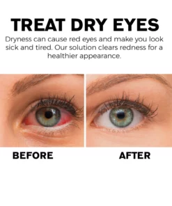 ATTDX Eye Problem Treatment Reversal Eye Drops