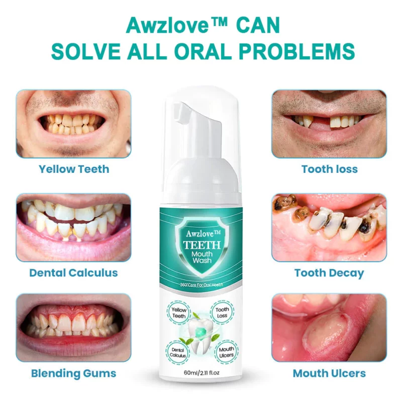 Awzlove™ TEETH Total Care Mouthwash - Solve all Oral Problems