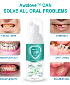 Awzlove™ TEETH Total Care Mouthwash - Solve all Oral Problems