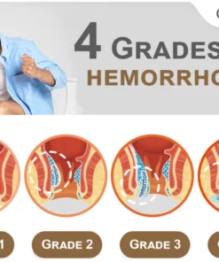 Calmez™ Hemorrhoids Treatment Spray