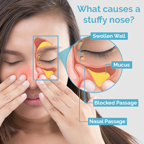 Ceoerty™ MucusRelief Nasal Cleansing Device