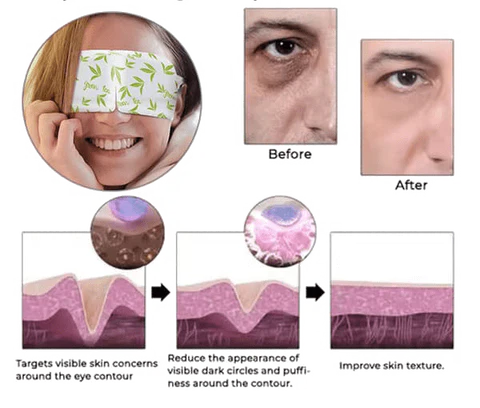 Msckt™ Plant extract eye spa steam eye mask
