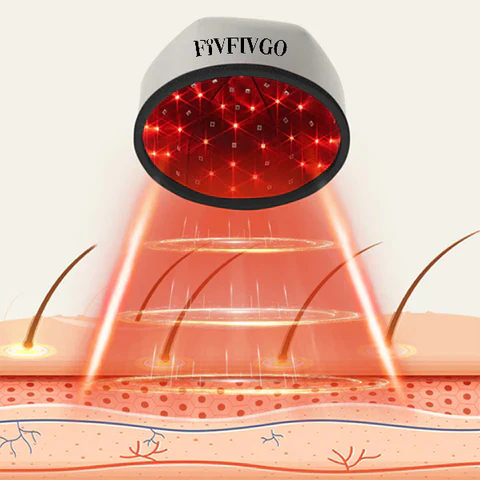 Oveallgo ™ Mobile Laser Therapy Cap for Hair Regrowth