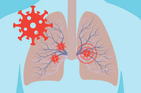 Seurico™ Organic Herbal Lung Cleanse Repair Nasal Spray