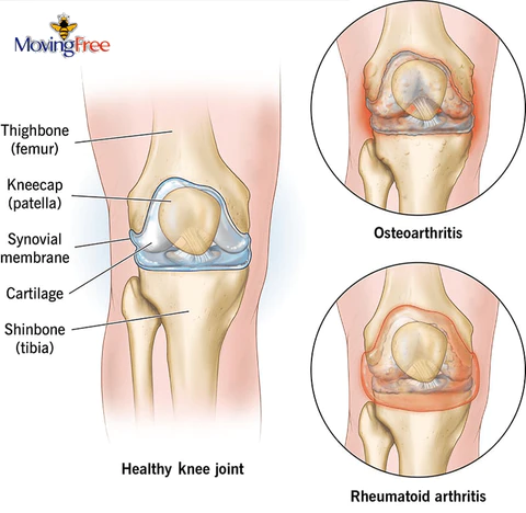 Seurico™ Joint & Bone Therapy Bee Venom Treatment Gel