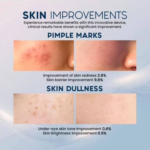 SkinRevive™ 5-min Collagen Booster