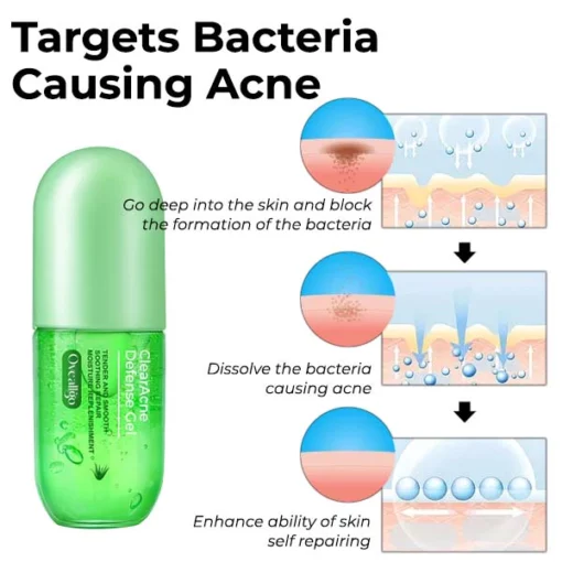 ZitZap™ Exclusive Patent Acne Skin Repair Expert-Cleansing and Acne