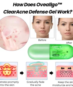 ZitZap™ Exclusive Patent Acne Skin Repair Expert-Cleansing and Acne