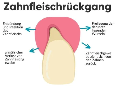 AEXZR™ Zahnfleisch-Therapie-Gel