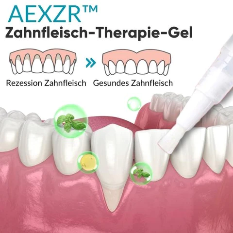 AEXZR™ Zahnfleisch-Therapie-Gel