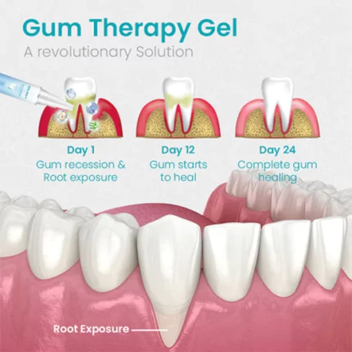 Awzlove™ Gum Shield Therapy Gel