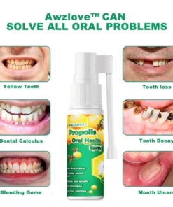 Awzlove™ Propolis Oral Health Spray