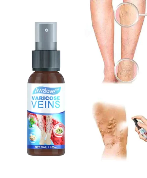 Awzlove™ Varicose Veins Spray